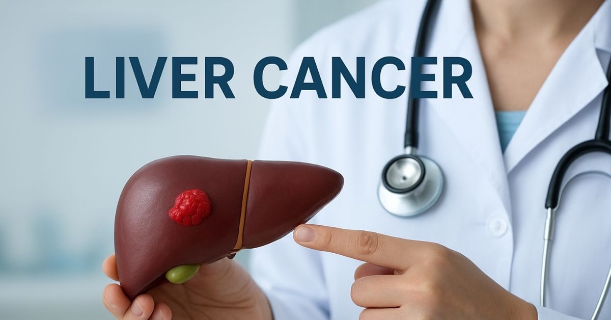 লিভার ক্যানসার